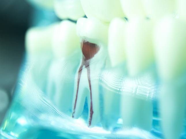 Model of tooth showing the nerve pathways inside of it