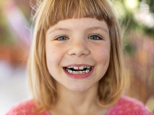 Little girl wearing metal appliances