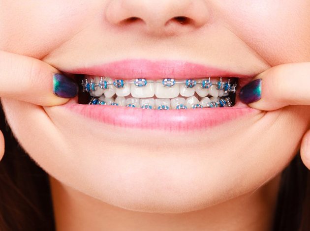 Girl with braces in patient&rsquo;s chair smiling in handheld mirror